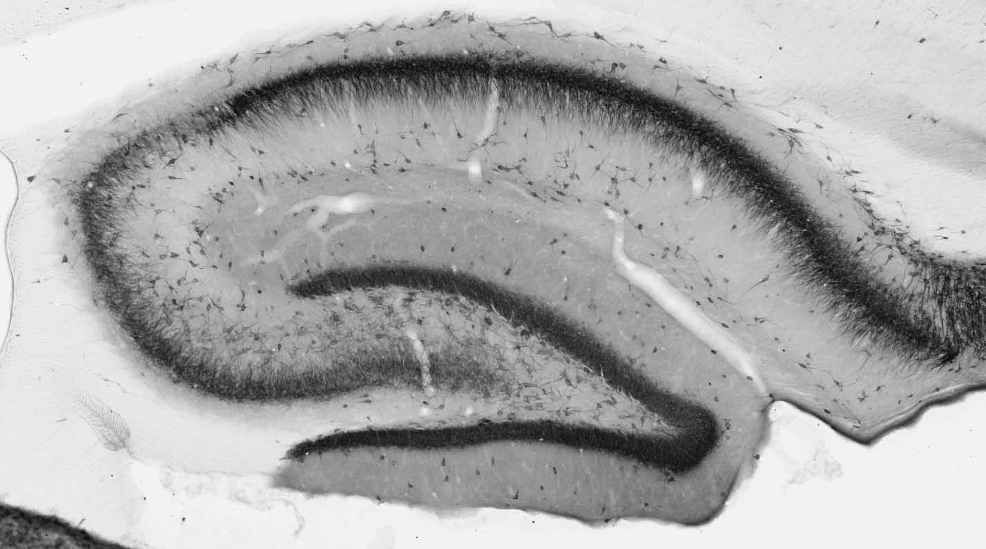 Anti-AMIGO-1 Antibody