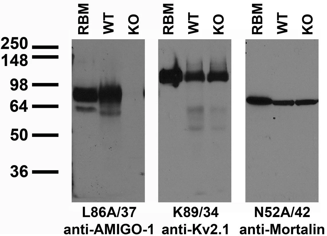 Anti-AMIGO-1 Antibody - Image 3
