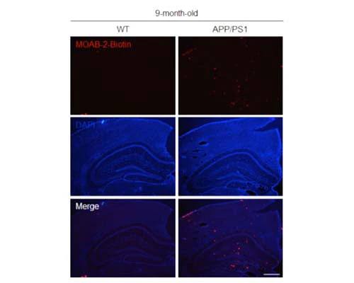 Anti-Amyloid beta peptide (A-beta 40/42) Antibody (Biotin)