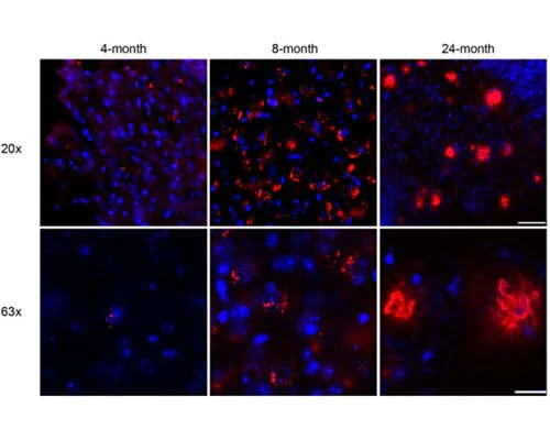 Anti-Amyloid beta peptide (A-beta 40/42) Antibody - Image 3