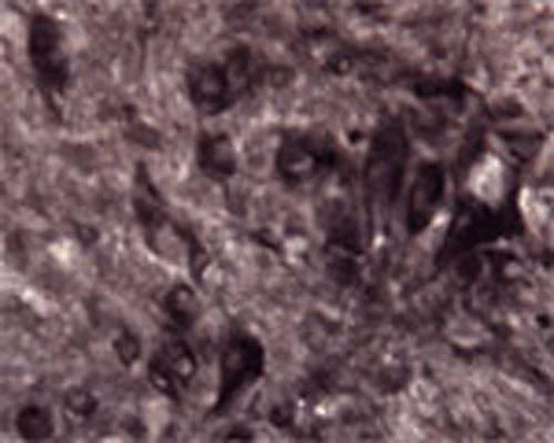 Anti-Amyloid-beta precursor protein (APP) Antibody