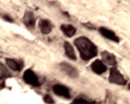 Anti-Amyloid-beta precursor protein (APP) Antibody