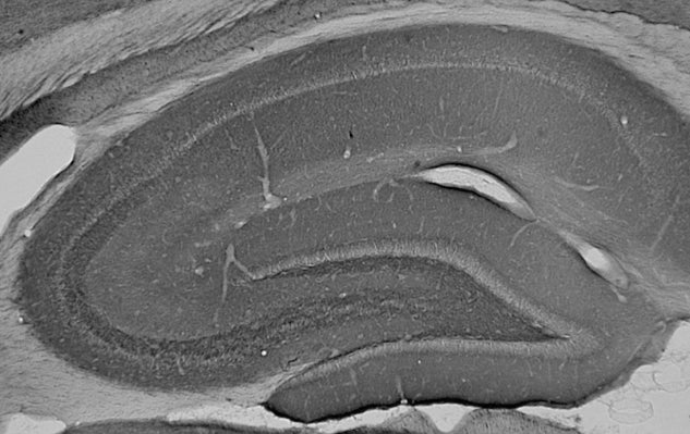 Anti-Ankyrin-B Antibody