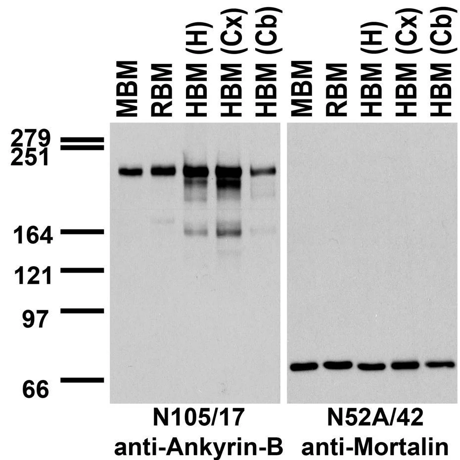 Anti-Ankyrin-B Antibody
