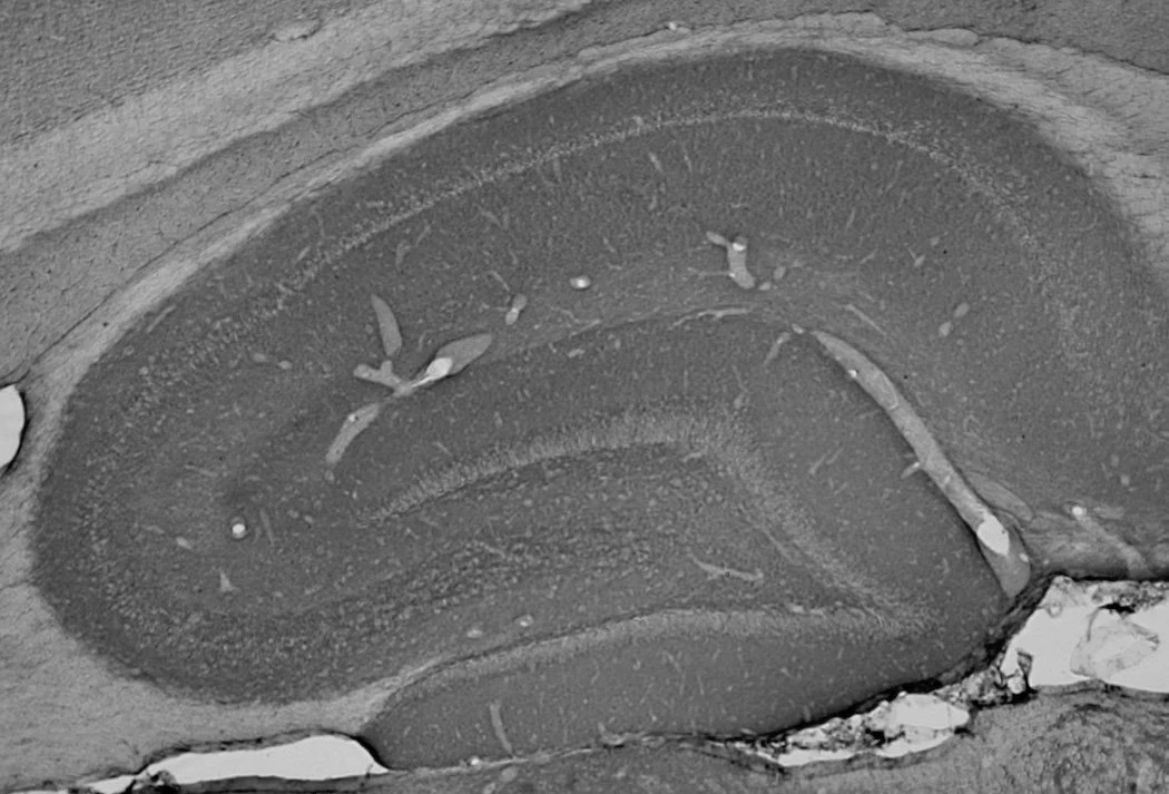 Anti-Ankyrin-B Antibody - Image 2