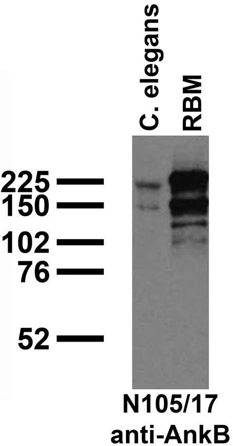Anti-Ankyrin-B Antibody - Image 3