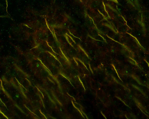 Anti-Ankyrin-G (Staining) Antibody