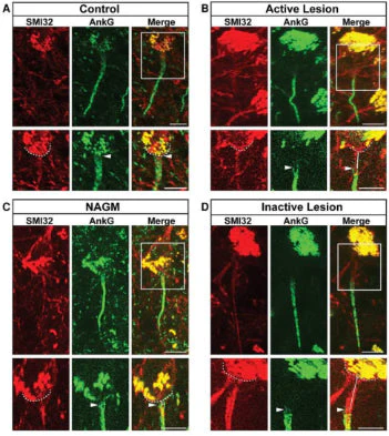 Anti-Ankyrin-G (Staining) Antibody - Image 10