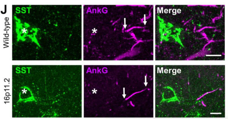 Anti-Ankyrin-G (Staining) Antibody - Image 11