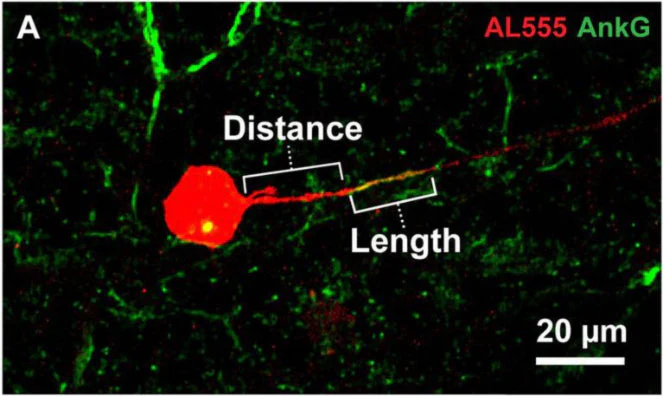 Anti-Ankyrin-G (Staining) Antibody - Image 12