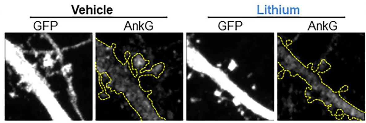 Anti-Ankyrin-G (Staining) Antibody - Image 13