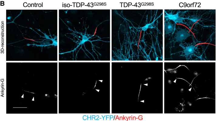 Anti-Ankyrin-G (Staining) Antibody - Image 19