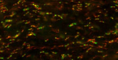 Anti-Ankyrin-G (Staining) Antibody - Image 2