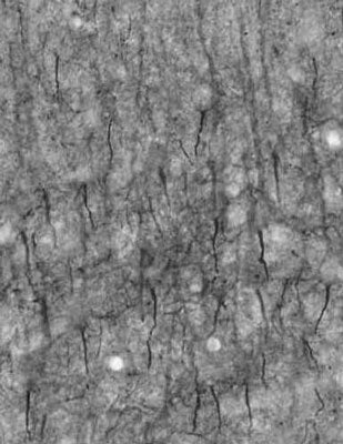 Anti-Ankyrin-G (Staining) Antibody - Image 3