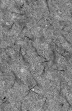Anti-Ankyrin-G (Staining) Antibody - Image 4