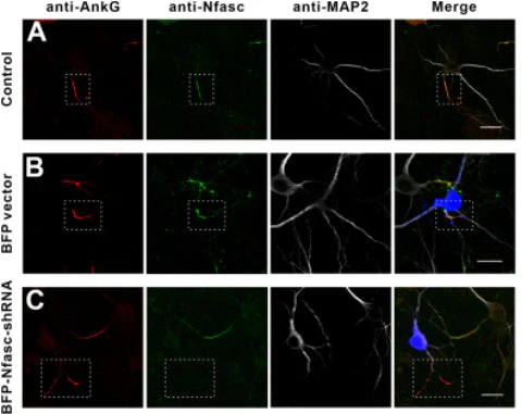 Anti-Ankyrin-G (Staining) Antibody - Image 5