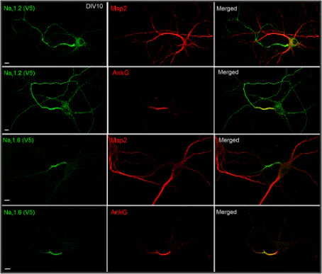 Anti-Ankyrin-G (Staining) Antibody - Image 6