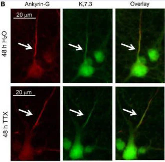 Anti-Ankyrin-G (Staining) Antibody - Image 9