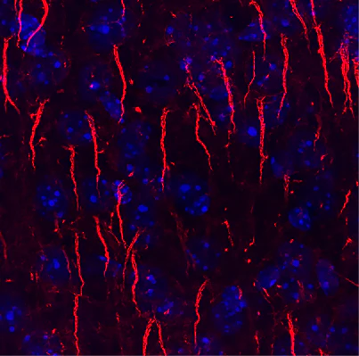 Anti-Ankyrin-G (Staining) Antibody