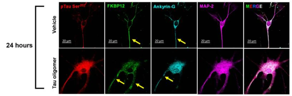Anti-Ankyrin-G (Staining) Antibody - Image 2