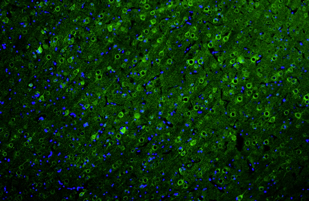 Anti-Ankyrin-G  Recombinant Chicken Chimeric mAb