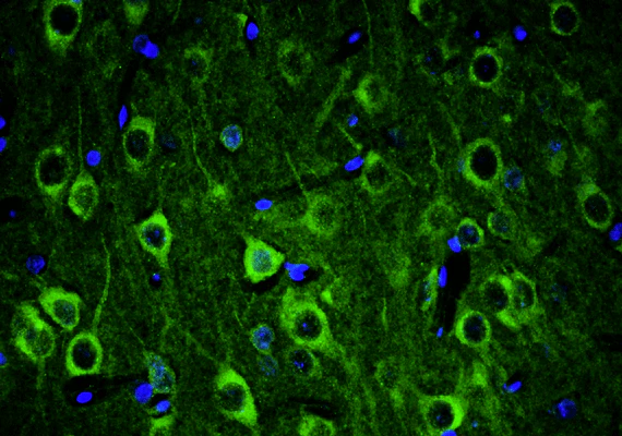 Anti-Ankyrin-G  Recombinant Chicken Chimeric mAb - Image 2