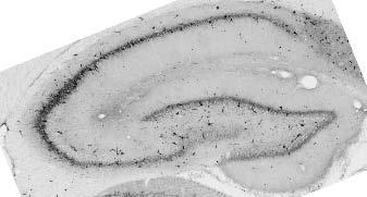 Anti-Ankyrin-R Antibody