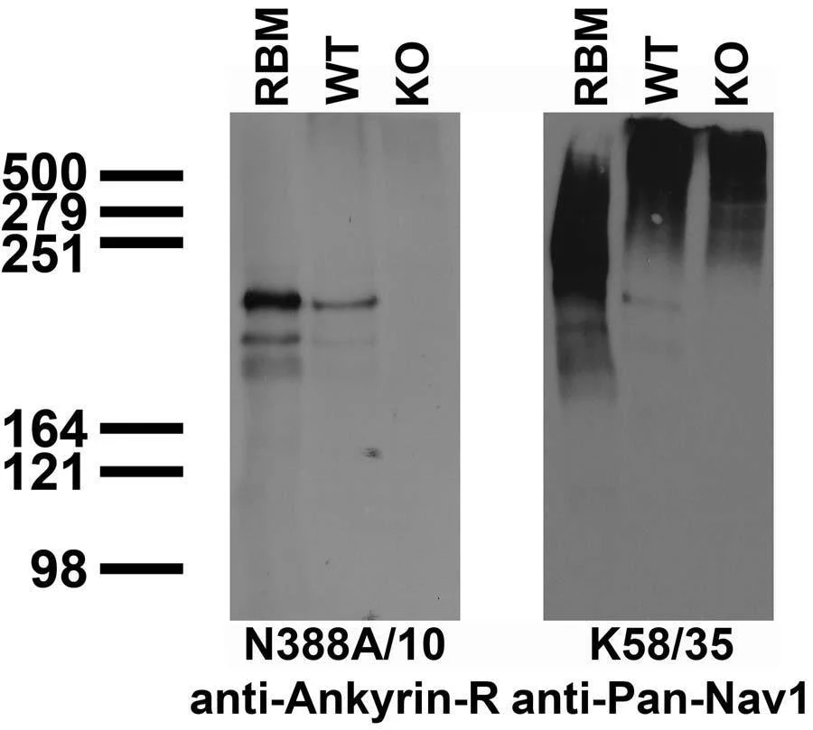Anti-Ankyrin-R Antibody - Image 2