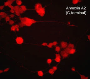 Anti-Annexin A2 (C-terminal region) Antibody - Image 2