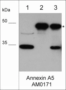 Anti-Annexin A5 Antibody - Image 2