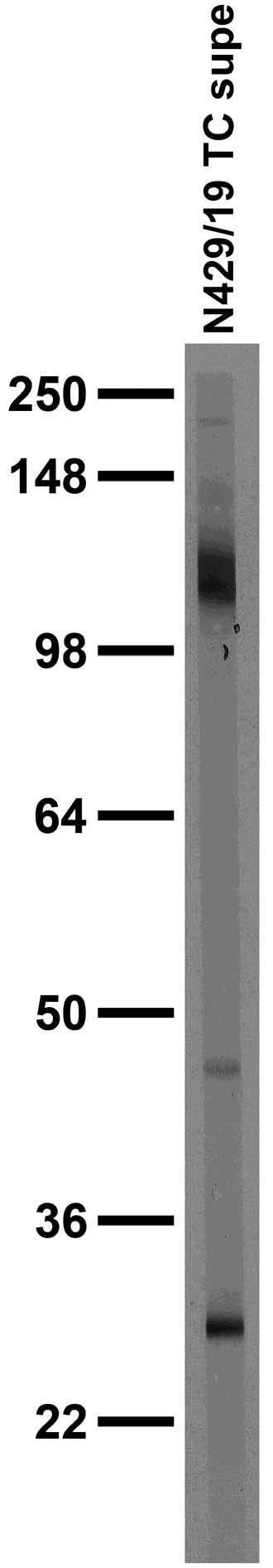 Anti-ANO6/TMEM16F Antibody - Image 2