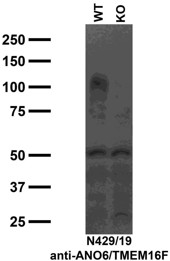 Anti-ANO6/TMEM16F Antibody - Image 3