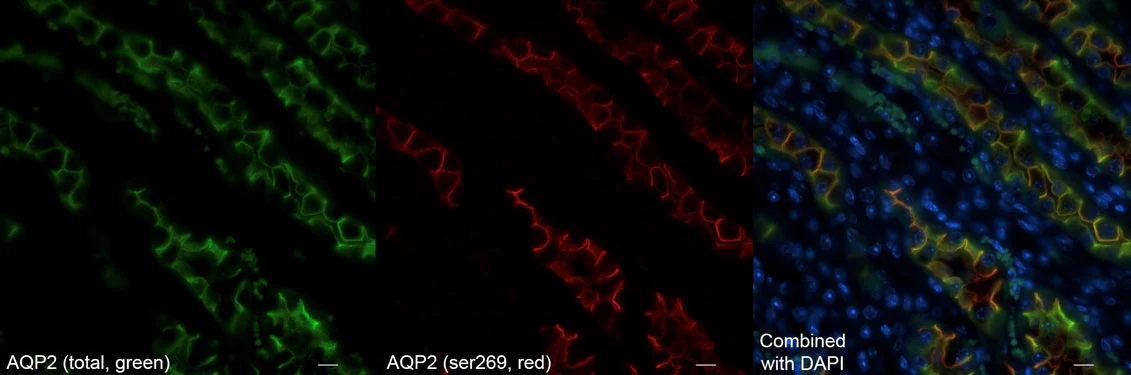 Anti-Aquaporin 2 (Ser269) Antibody - Image 2