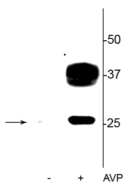 Anti-Aquaporin 2 (Ser269) Antibody - Image 3