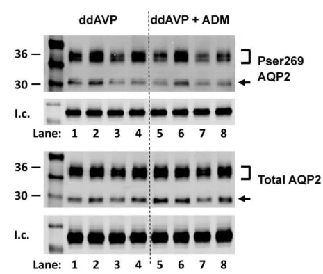 Anti-Aquaporin 2 (Ser269) Antibody - Image 4