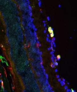 Anti-Arginase I (ARG1) Antibody