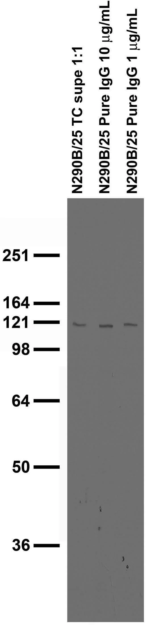Anti-ARHGAP4 Antibody - Image 2