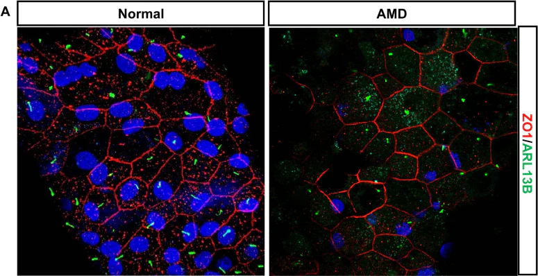 Anti-Arl13b Antibody - Image 13
