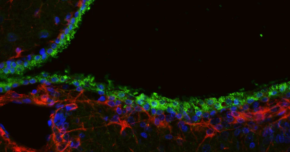 Anti-Arl13b Recombinant Guinea Pig Chimeric mAb - Image 2