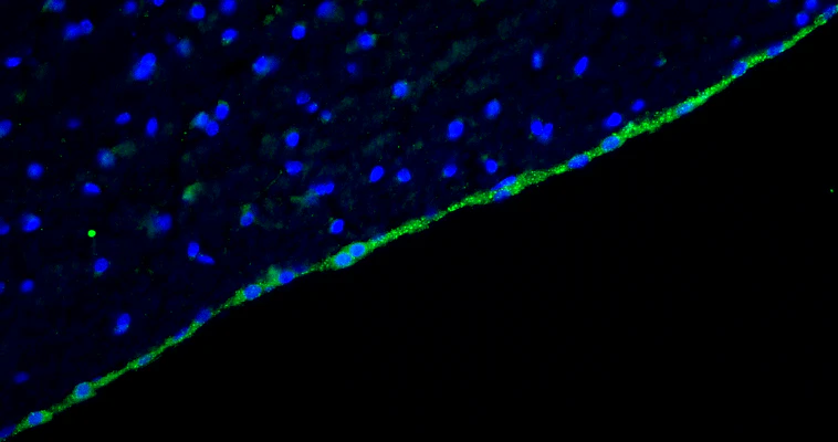 Anti-Arl13b Recombinant Chicken Chimeric mAb