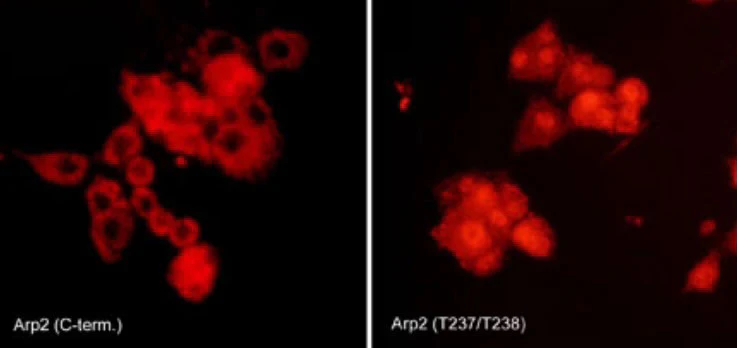 Anti-Arp2 (C-terminal region) Antibody - Image 2