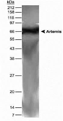 Anti-Artemis Antibody