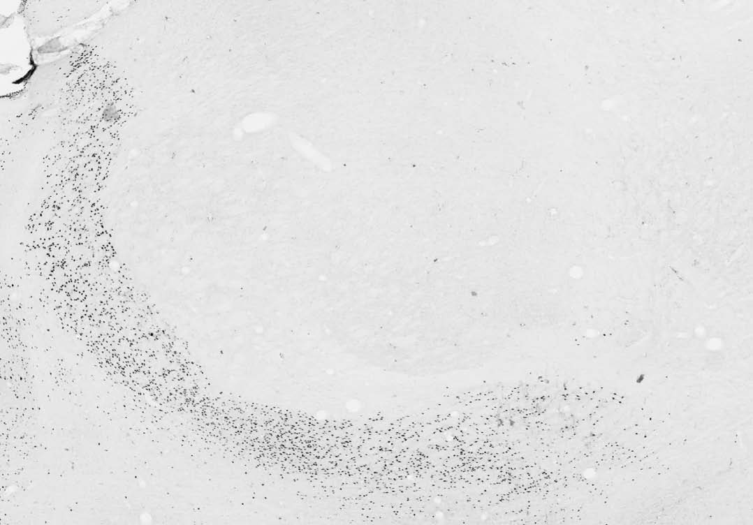 Anti-Arx Antibody - Image 2