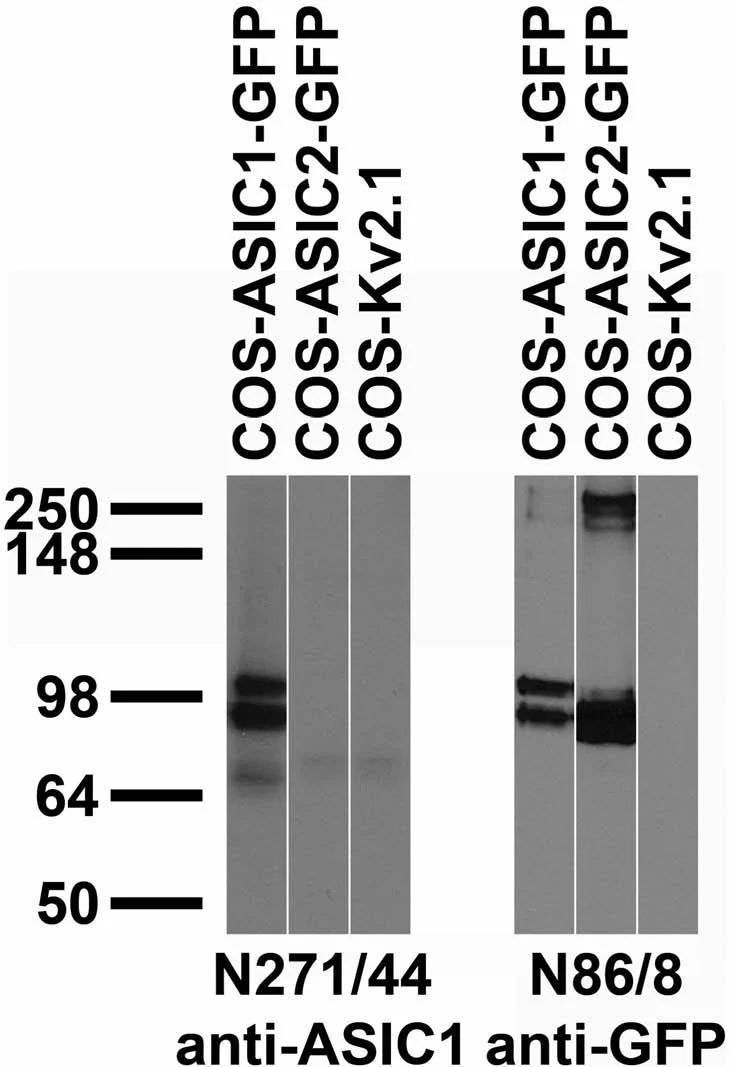 Anti-ASIC1 Antibody