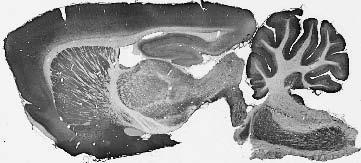 Anti-ASIC1 Antibody - Image 2