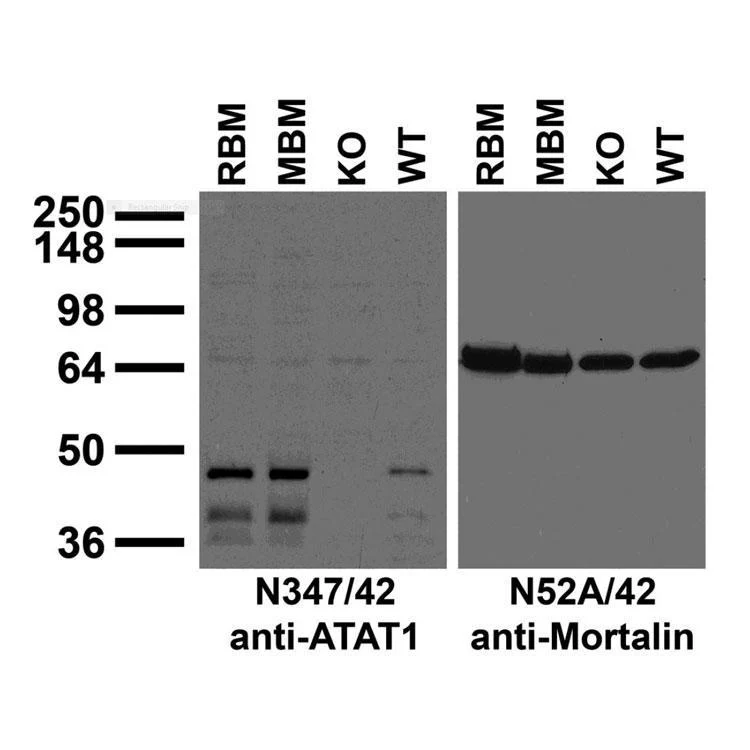 Anti-ATAT1 Antibody