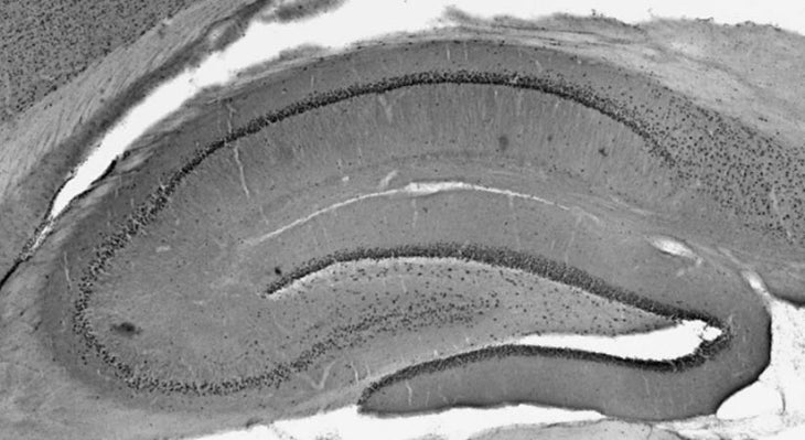 Anti-Ataxin-1, 11NQ Antibody