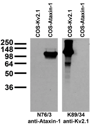 Anti-Ataxin-1, 11NQ Antibody - Image 2