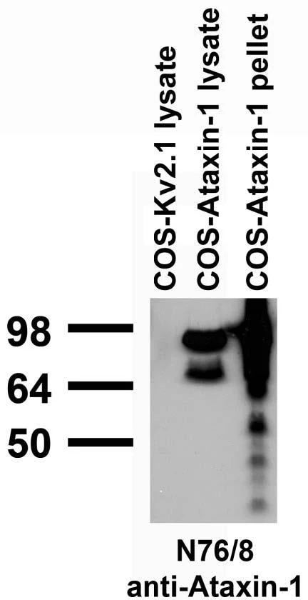 Anti-Ataxin-1, 11NQ Antibody