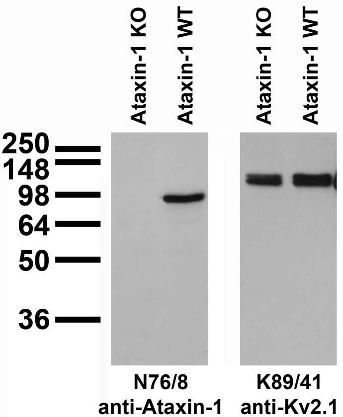 Anti-Ataxin-1, 11NQ Antibody - Image 2